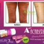 Acaiberry Slimming Plus Whitening